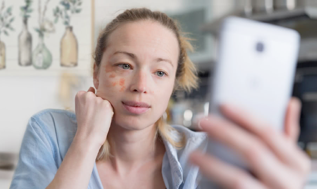 patient with skin problem talking to a doctor online